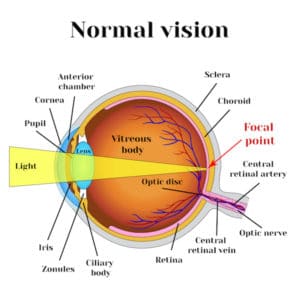 Normal Vision