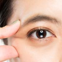 Get dry eye treatment in New York at I Love LASIK, model showing her dry eye symptoms.